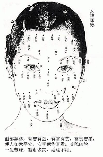 女人面部痣的位置与命运图